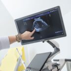 ultragarsas nėštumo metu